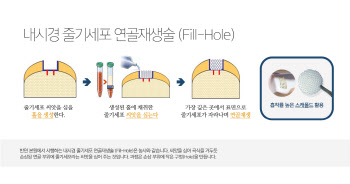 ‘의사형! 내 발목이 왜이래?’... 너무 자주 발목이 삔다면?