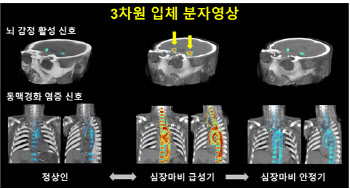 ‘화 내면 왜 심장마비 발생하는 이유가 있네’