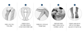 무릎 인공관절수술은 위험할까? 막상 수술 환자 만족도는 높아