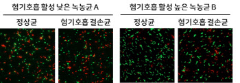 패혈증 유발하는 녹농균의 항생제 내성 원인 규명