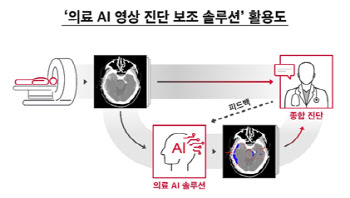 CT 분석도 인공지능이…SKT, AI 의료 영상진단 솔루션 개발