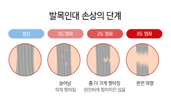 발목 인대 파열을 방치하다가는 만성적 불안정증이 진행될수도