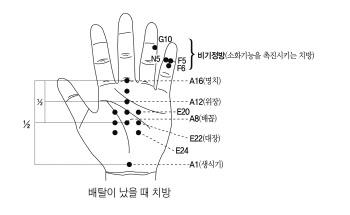 폭염의 휴가철, 수지침으로 올 여름을 건강 하게