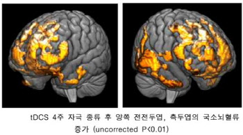 왓슨앤컴퍼니 ‘포커스’, 전전두엽·측두엽 국소뇌혈류 증가 확인