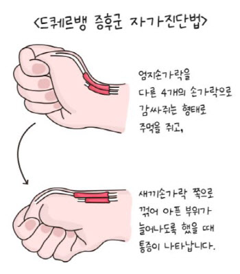 갓 출산한 엄마들의 손목은 왜 아픈 걸까?