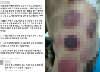 ‘부항으로 백신액 뽑아내면 부작용 없다?’