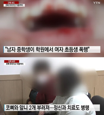 男중학생이 女초등생 폭행 '코뼈·앞니 부러져.. 학교도 못가'