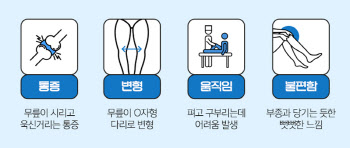 당신의 무릎 건강 상태, 소리로 알 수 있다