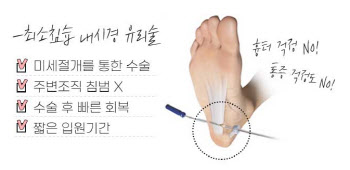 당신의 발도 늙는다는 증거 '족저근막염'