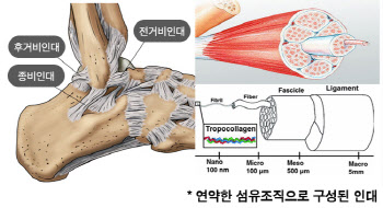 길을 가다 삐끗, 발목 자주 삔다면 부상 아닌 질환이 원일 일수도