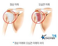 오십견이 다 나았다는 착각이 병을 키울수도 있다