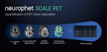 뉴로핏, PET 영상 자동분석소프트웨어 '뉴로핏 스케일 펫' 美 FDA 허가 획득