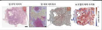 서울대 권성훈 교수 연구팀, AI 차세대 암 진단 지표 개발