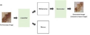 피부암 흑색종, 최적 조직검사 위치 제시 新 AI 시스템 개발