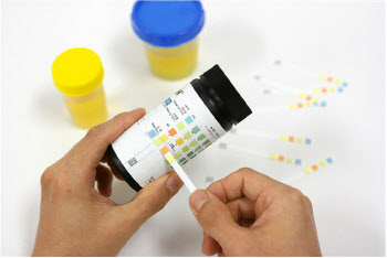 ‘소변’으로 신장병 유무를 알수 있다