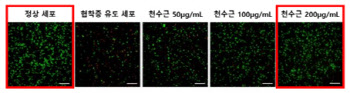 자생한방병원, 청파전의 척추관협착증 치료 기전 입증