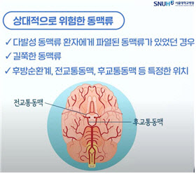 머릿속 시한폭탄 뇌동맥류, 사전에 증상과 수술법 파악하는 것이 중요