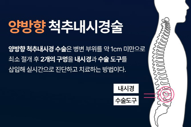 [대찬병원] 허리디스크! 양방향 7