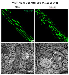 고칼로리 식이에 의한 당뇨병 발생 기전 최초 규명