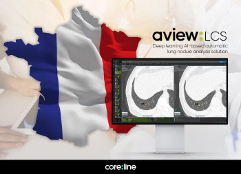 코어라인소프트, 프랑스 최대 사립병원 그룹에 AI 진단솔루션 공급