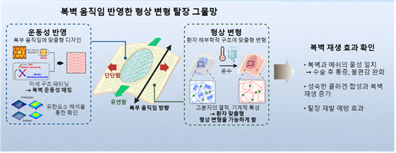 실제 복벽 환경 구현한 탈장 그물망 개발... 탈장 재발 위험 낮춰