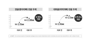 무릎 관절염, 줄기세포 주사 치료가 도움