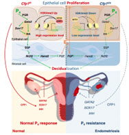 자궁내막증 유발하는 후성유전학적 조절 과정 규명