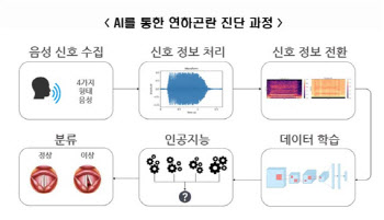 목소리만으로 뇌졸중 후 연하장애 조기 진단 가능