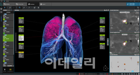 코어라인소프트, 북미영상의학회서 의료영상AI 전 제품 시연