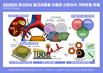 신장이식 환자 피 한 방울로 이식 거부반응 조기진단 가능