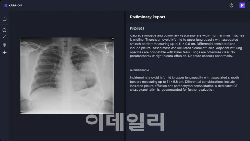 의사 부족 시대...성큼 다가온 韓 'AI 의사'[생성형 의료AI시대]①