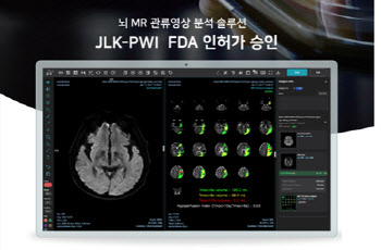 제이엘케이, 뇌졸중 솔루션 네번째 美 FDA 승인 쾌거