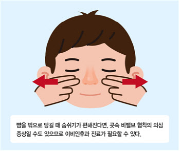 콧속 공기 통로 ‘비밸브’ 협착 진단의 새로운 기준 발표