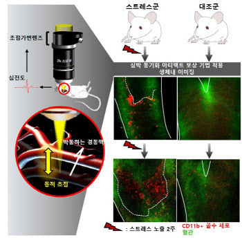 만성 스트레스에 의한 혈관질환 발생 이유 세포추적 영으로 밝혀