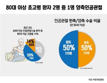 고령의 인공관절 수술 전 '이것'반드시 확인해야