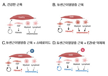 EZH2 억제제로 듀센근이영양증 근육섬유화 감소. 근력향상 효과 입증