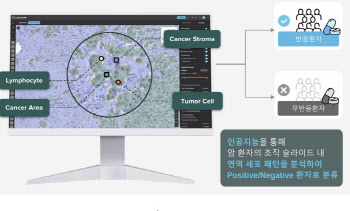 AZ·제넨텍의 선택,루닛 동반진단 솔루션 2027년 상용화...잭팟 터질까?