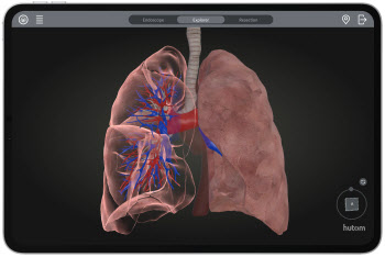 휴톰, 폐암 수술 특화 ‘RUS LUNG’ 출시…"흉부외과 시장 진출"