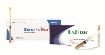 한스바이오메드, 中 동종골 이식재 수출 개시…5000억 시장 선점 가속