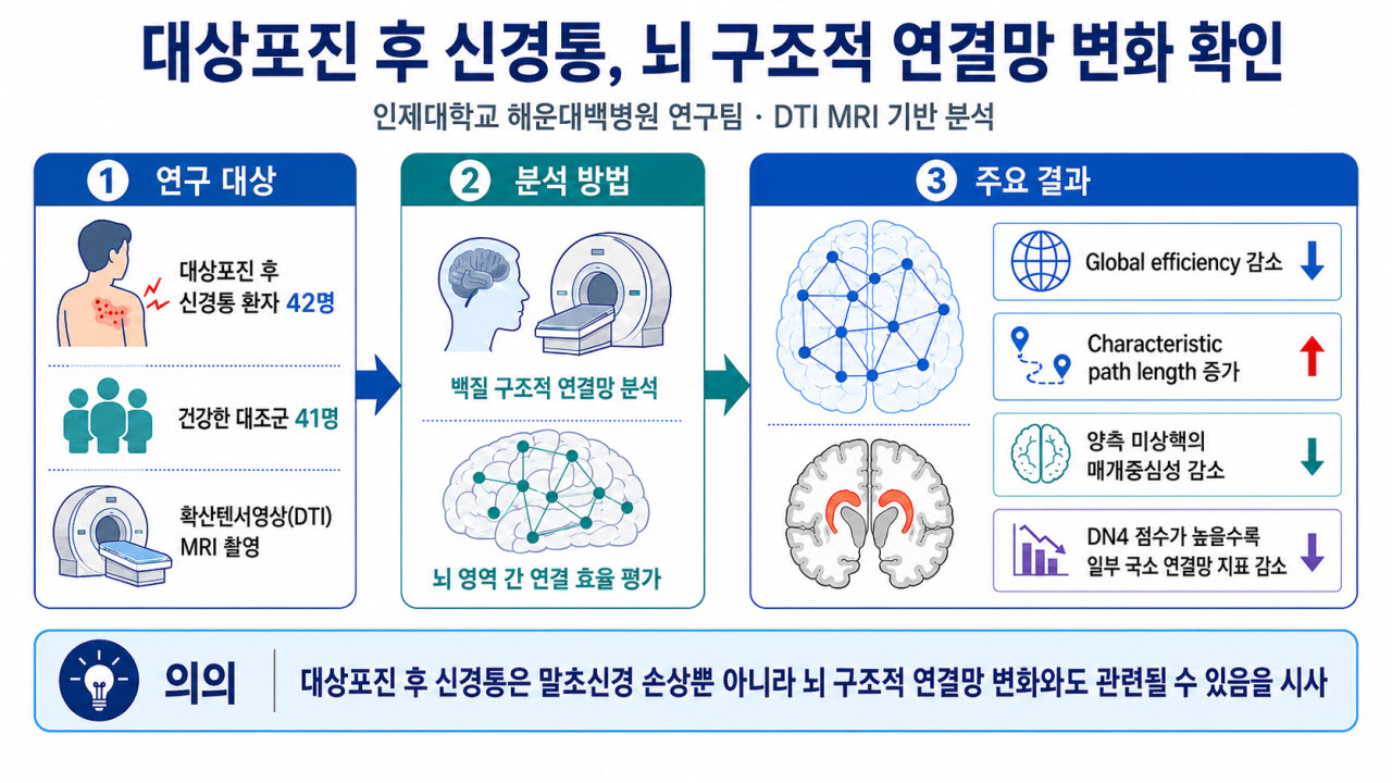대상 포진 후 신경통, 뇌 구조족 연결망 변화 확인. [연구 모식도]