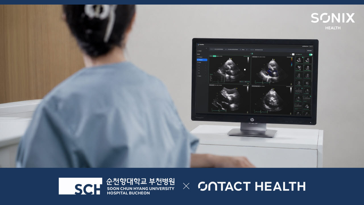 온택트헬스, 순천향대 부천병원에 AI 심장초음파 분석 솔루션 ‘소닉스헬스’ 공급