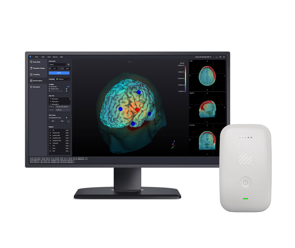 뉴로핏 개인 맞춤형 경두개직류자극술(tDCS) 솔루션 제품 모습 (사진=뉴로핏)