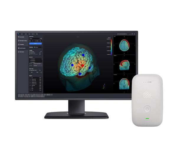뉴로핏 개인 맞춤형 경두개직류자극술(tDCS) 솔루션 제품 모습 (사진=뉴로핏)