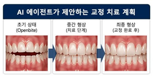 라온피플 자회사 라온메디, 국가전략 AI 의료과제 선정
