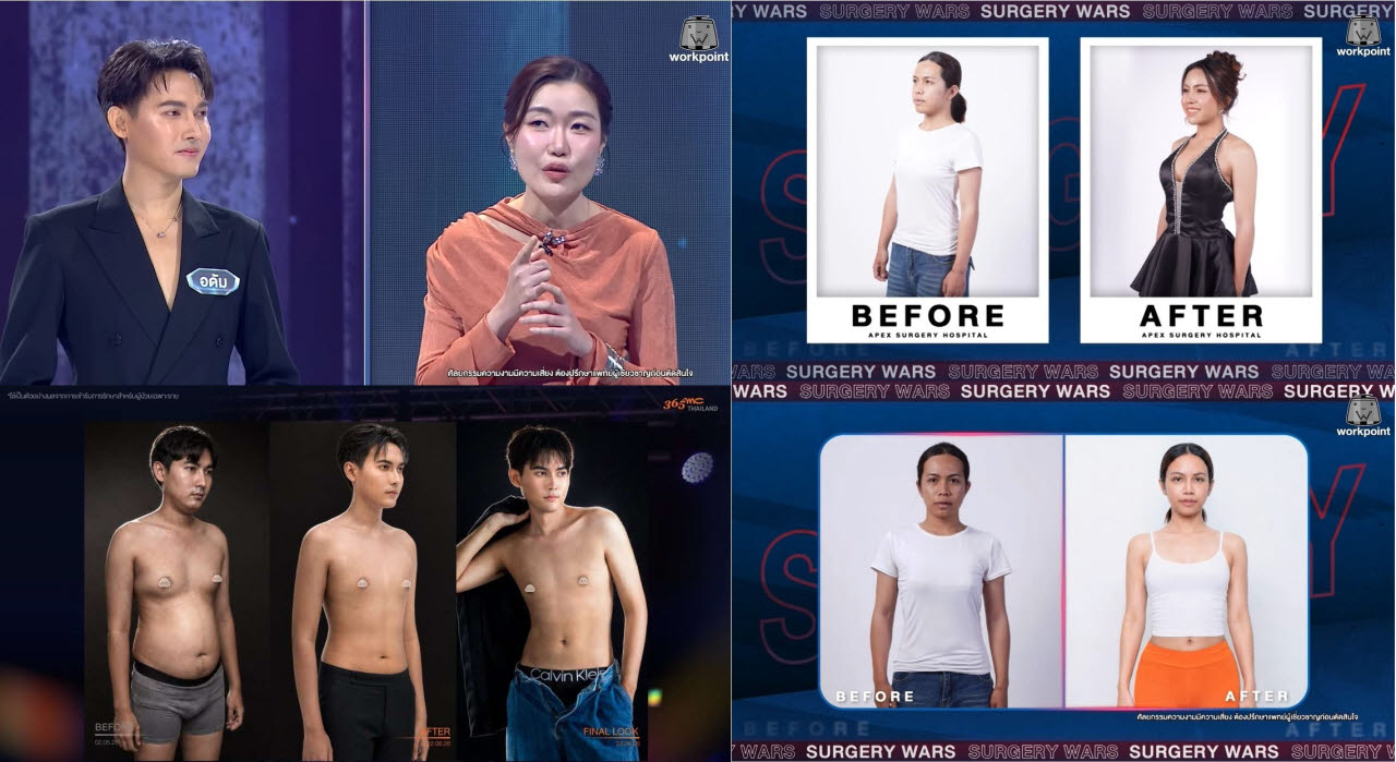 365mc, 태국서 K-지방흡입으로 트랜스젠더 새 삶 선사
