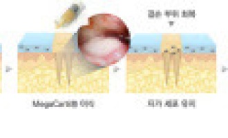 엘앤씨바이오,메가카티 조기출시 사상 최대실적 자신