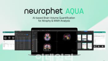 뉴로핏, 다발성 경화증 분석 기능 탑재한 AI진단 SW로 美 FDA 허가