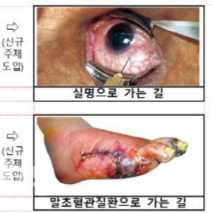 토토 씨벳