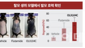 [임상 업데이트] 올릭스, 탈모치료제 ‘OLX104C’ 글로벌 임상 1b/2a상 승인 신청