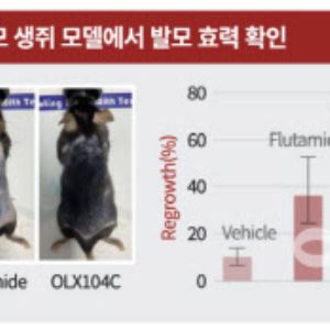 [임상 업데이트] 올릭스, 탈모치료제 ‘OLX104C’ 글로벌 임상 1b/2a상 승인 신청